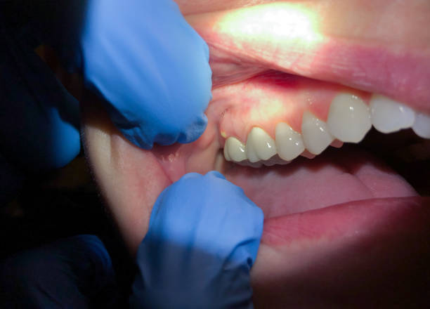 Best Cosmetic Emergency Dentistry in Dundas, MN