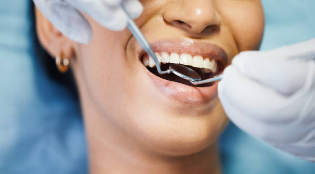 Best Emergency Dental Care for Broken or Chipped Teeth in Dundas, MN